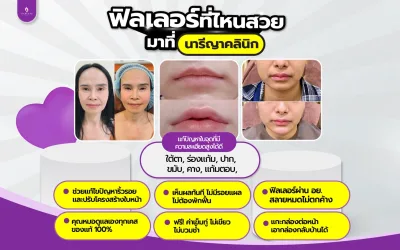 ฟิลเล่อร์ที่ไหนดี ฟิลเลอร์ที่ไหนสวย