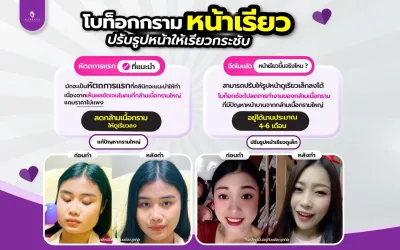 โบท็อกกราม