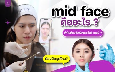 midface คืออะไร?