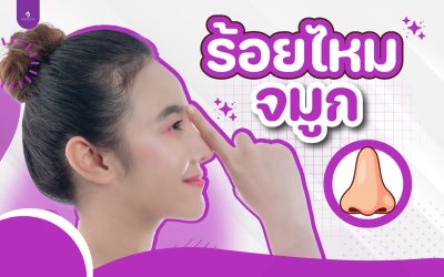 ร้อยไหมจมูกคืออะไร?