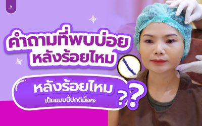 การร้อยไหมดึงหน้า ปรับรูปหน้า ยกกระชับหน้า