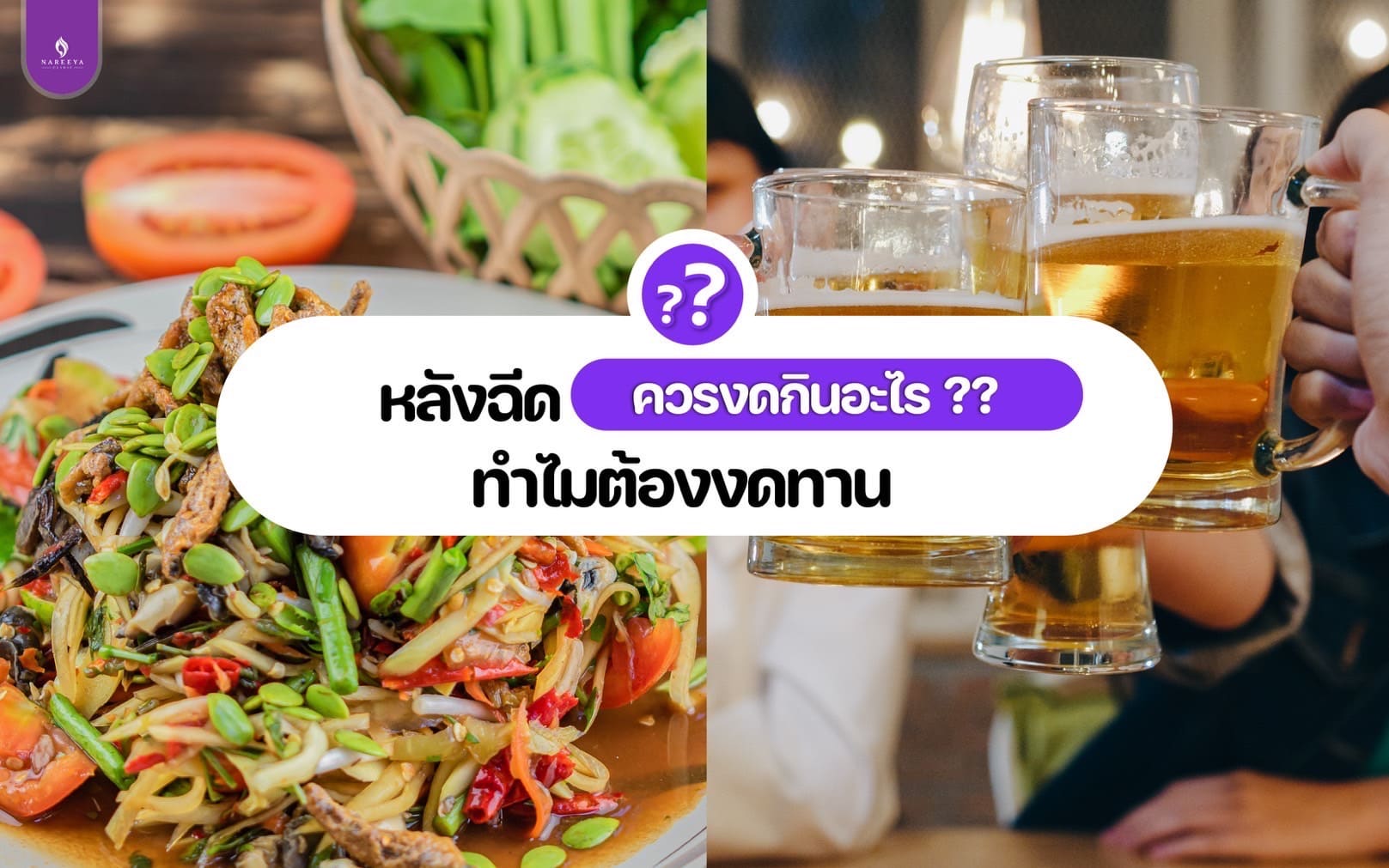 ฟิลเลอร์ (4)