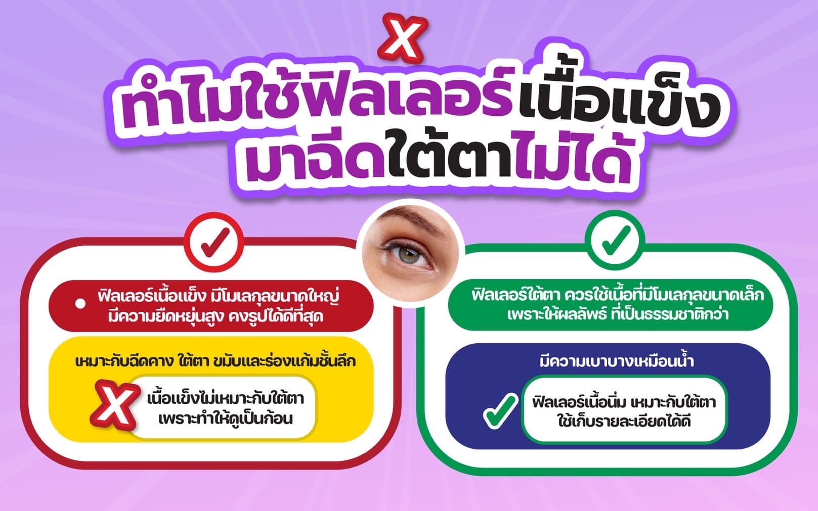 ฟิลเลอร์ใต้ตา (1)