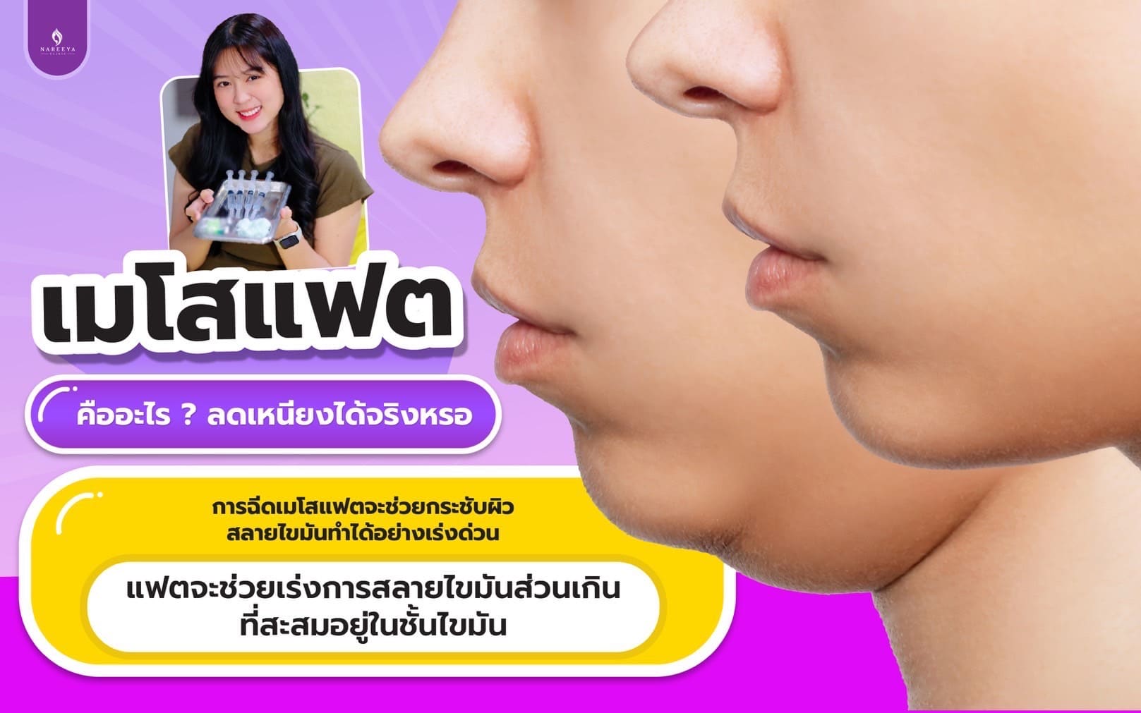 เมโสแฟต-3