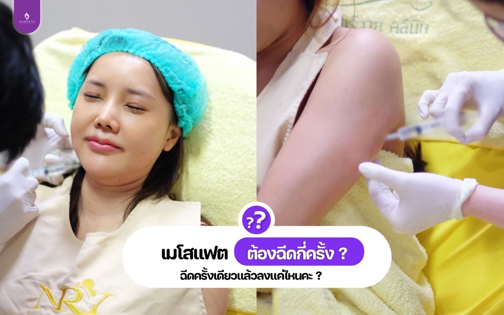 เมโสแฟต-4