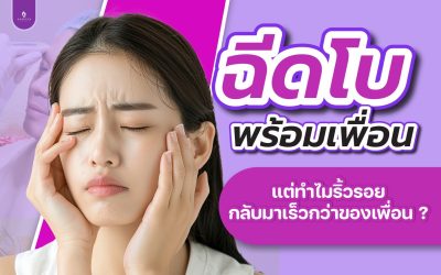 ฉีดโบท็อกซ์พร้อมเพื่อน แต่ทำไมริ้วรอยกลับมาเร็วกว่าของเพื่อน??