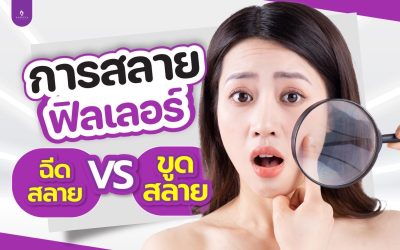 ฉีดสลายฟิลเลอร์ คืออะไร ? 
