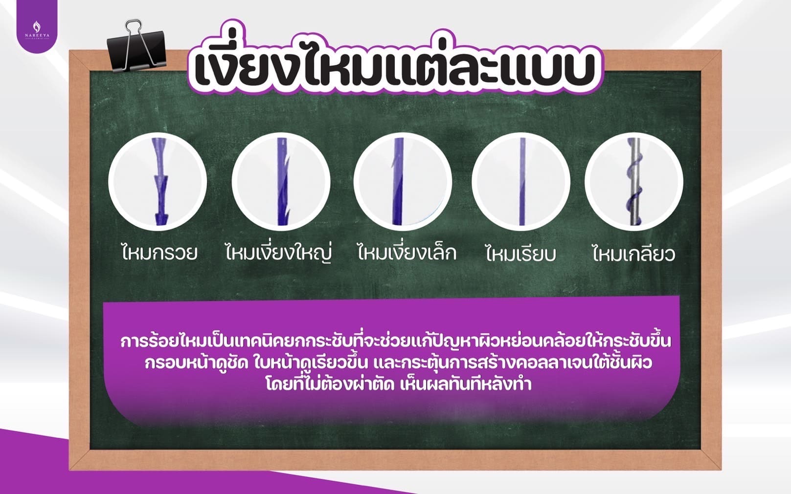 ร้อยไหม (3)