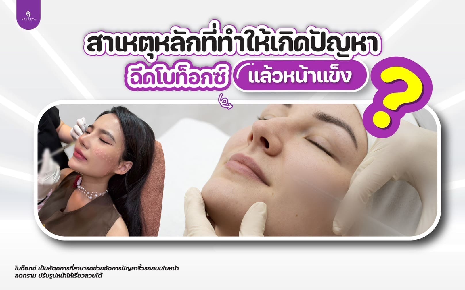 โบท้อก (2)