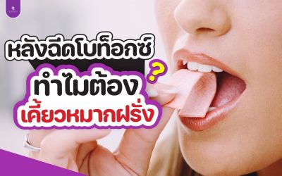 หลังฉีดโบท็อกซ์ทำไมต้องเคี้ยวหมากฝรั่ง??