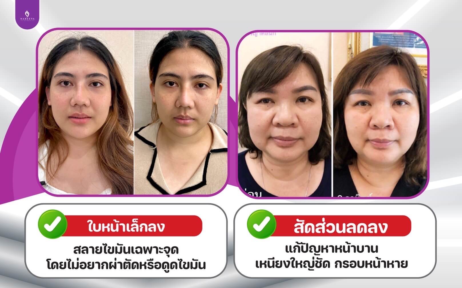fat ลดไขมัน (4)