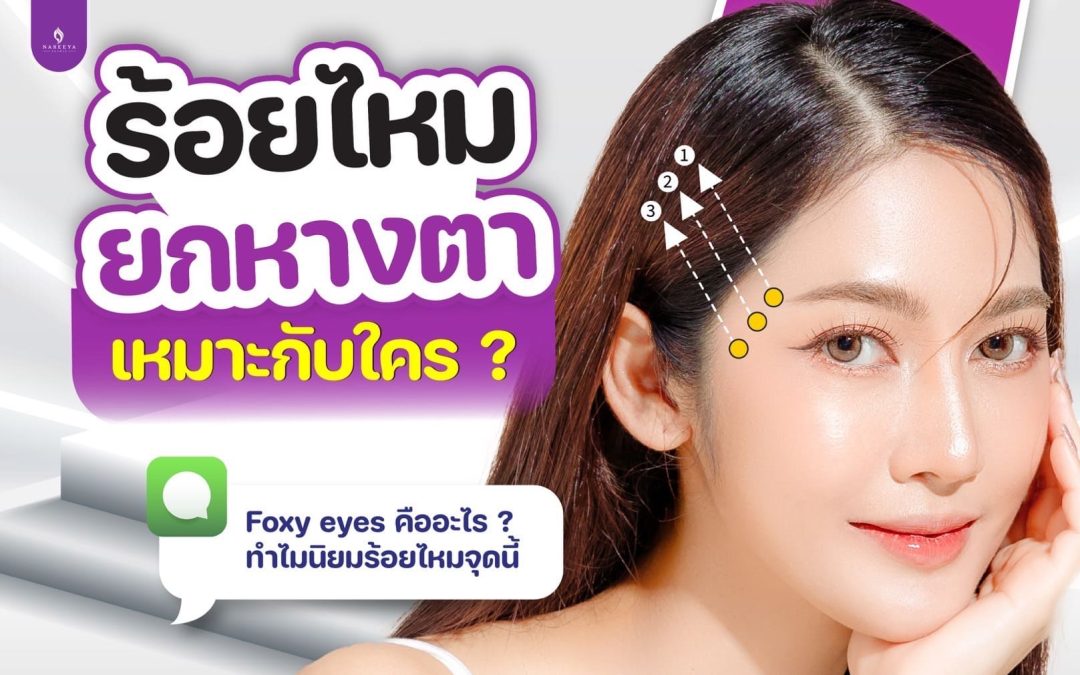 การร้อยไหม Foxy Eyes คือ
