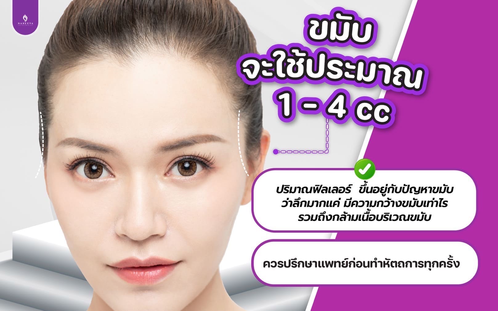 ฟิลเลอร์ขมับ (3)