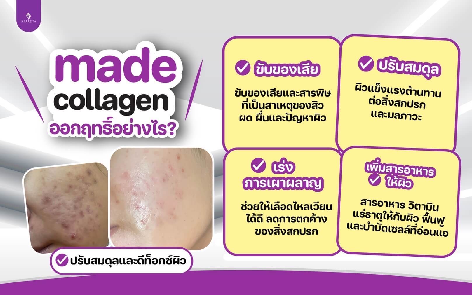 มาเด้คอลลาเจน (4)
