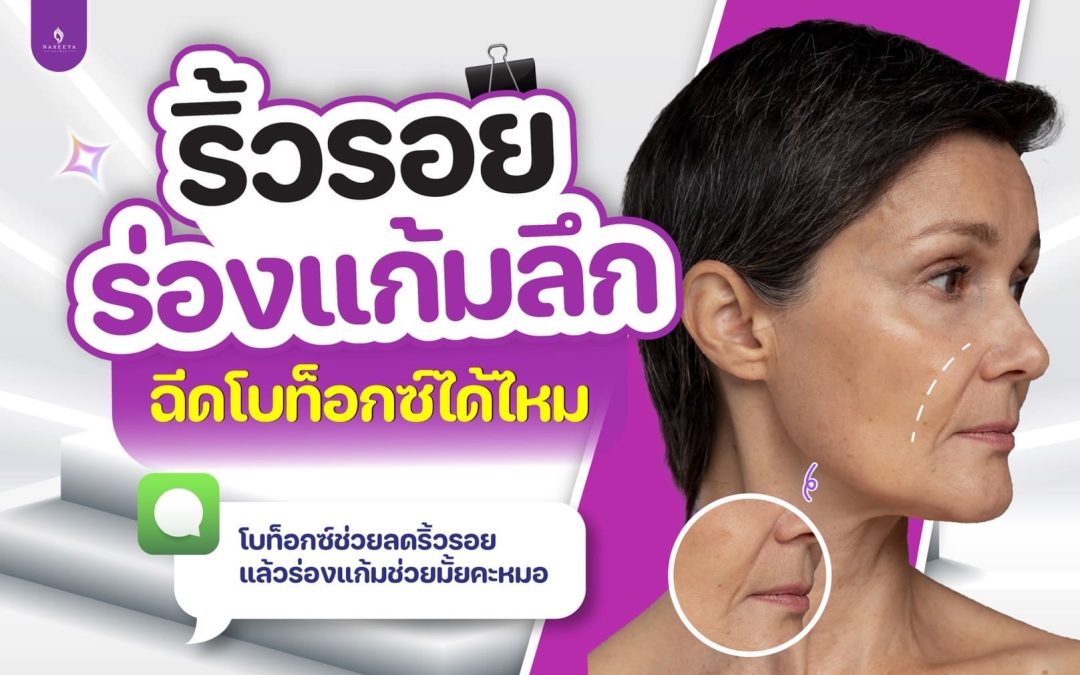 ริ้วรอยร่องแก้มลึกฉีดโบท๊อกได้ไหม