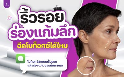 ริ้วรอยร่องแก้มลึกฉีดโบท๊อกได้ไหม