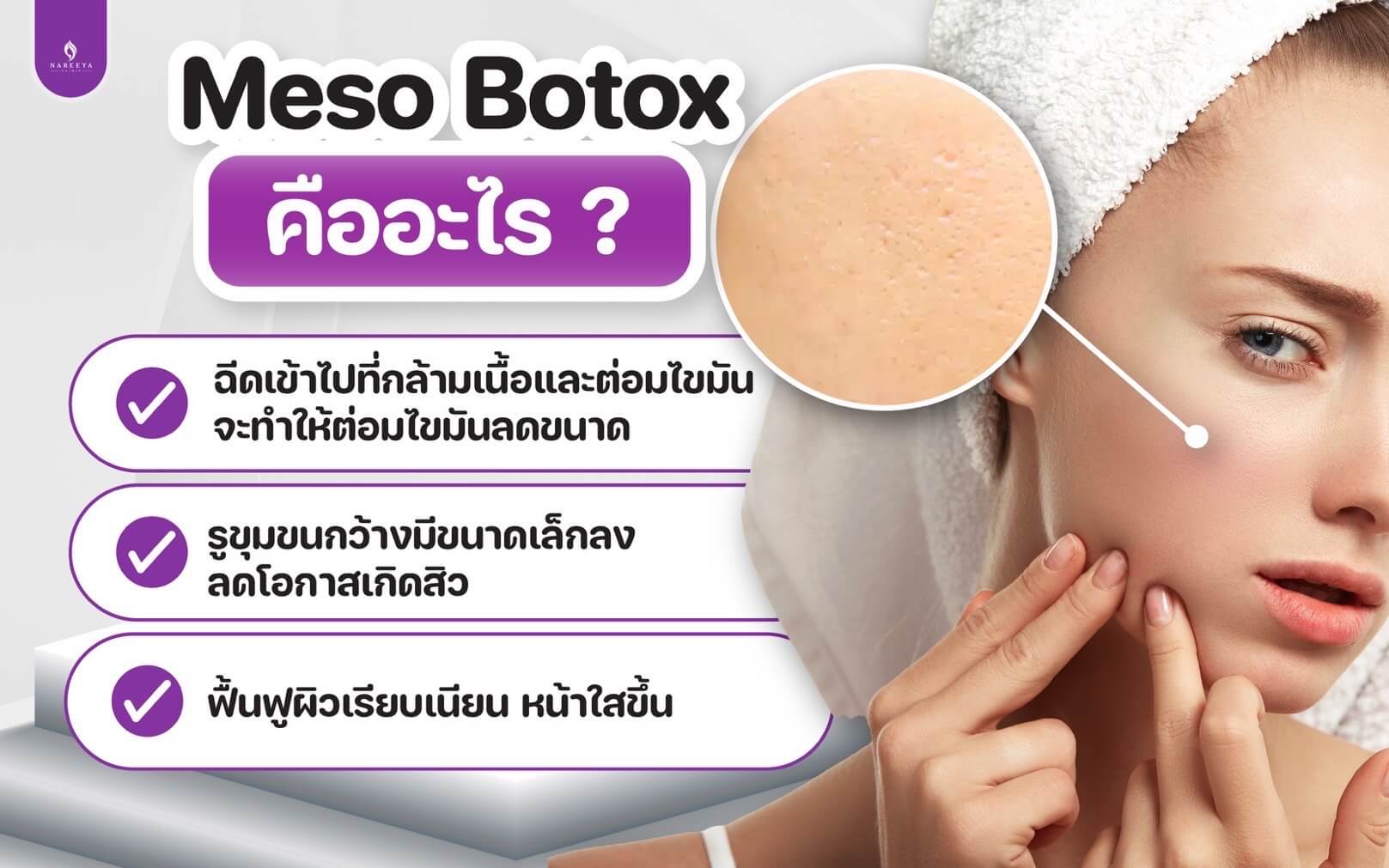 เมโส โบท็อกซ์ (2)