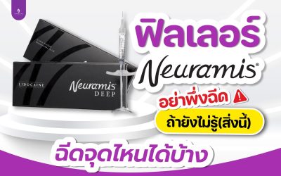 ฟิลเลอร์ Neuramis อย่าพึ่งฉีดถ้ายังไม่รู้สิ่งนี้ ฉีดจุดไหนได้บ้าง??
